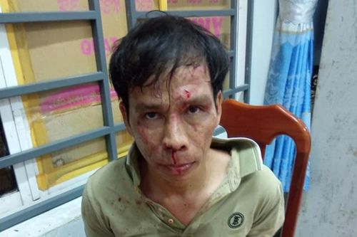 Bà Rịa - Vũng Tàu: Tạm giữ đối tượng dùng hung khí tấn công Thiếu tá Công an