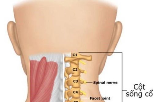 Điều trị thoái hóa cột sống cổ bằng cách nào là tốt nhất?