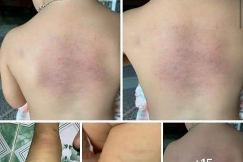 Xác minh thông tin bảo mẫu có dấu hiệu bạo hành trẻ em tại một nhà trẻ tư thục