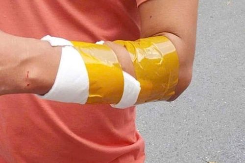 Làm rõ vụ người đàn ông cầm kéo tấn công tài xế taxi công nghệ