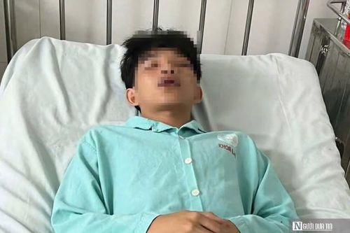 Điều tra vụ mâu thuẫn trong giờ ra chơi, một học sinh bị đánh nhập viện