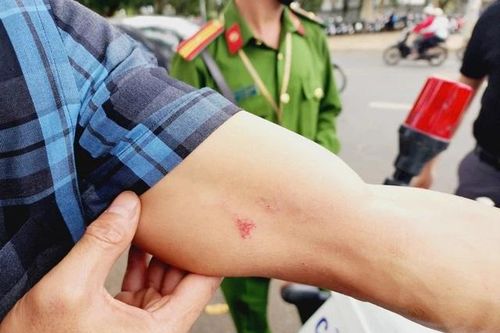 Đắk Lắk: phóng viên báo Công an Nhân dân tố bị hành hung khi tác nghiệp