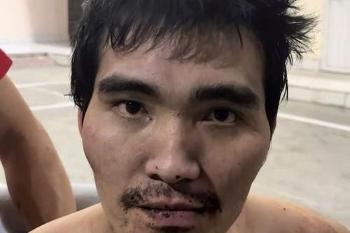 Gã đàn ông biểu hiện thần kinh cầm dao phay chém người đi đường