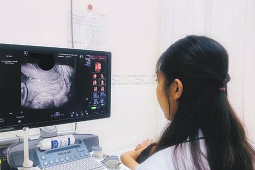 Dự phòng sinh non