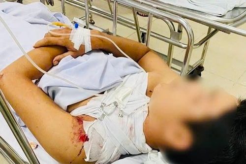 Bình Thuận: Điều tra vụ người can ngăn cãi lộn bị chém