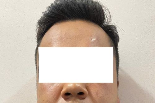 Lộ đủ thứ!