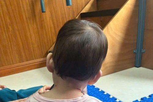 Sai lầm khiến trẻ bị vẹo cổ cha mẹ cần tránh
