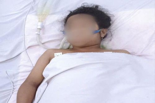 Bệnh viện Sản - Nhi An Giang cứu sống bé gái sốc sốt xuất huyết nặng