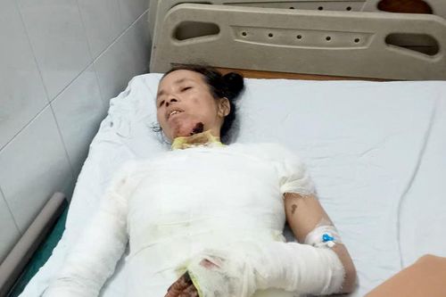 Chị Đặng bị bỏng toàn thân cần giúp đỡ