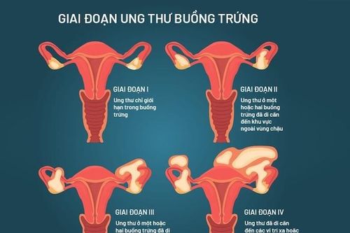 Tác động nghiêm trọng từ một trong những bệnh ung thư có tỷ lệ sống sót rất thấp
