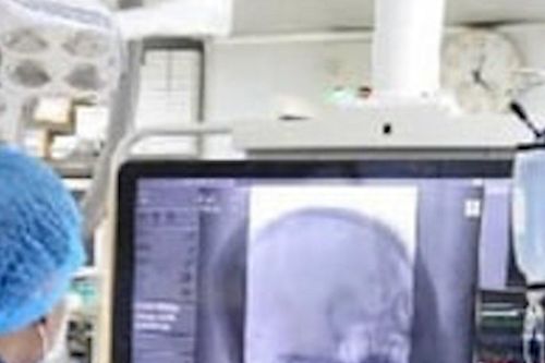 Cứu sống bé trai 12 tuổi đột quỵ khi đang học bài