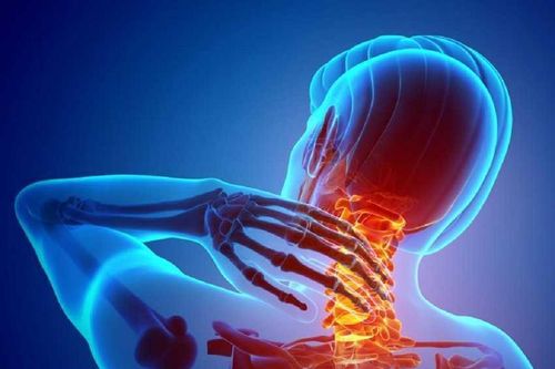 Hội chứng đầu cổ: Nguyên nhân, biểu hiện, cách điều trị và phòng bệnh