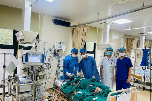 Kỹ thuật ECMO hồi sinh bệnh nhân đã ngừng tuần hoàn