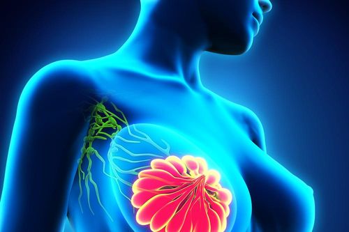 Thay đổi phương pháp điều trị ung thư vú giai đoạn đầu