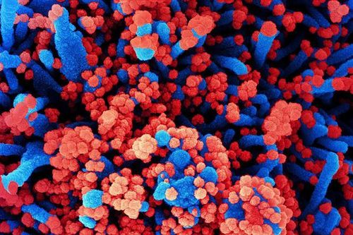Nga lên tiếng về loại virus chưa xác định gây ra tình trạng ho ra máu