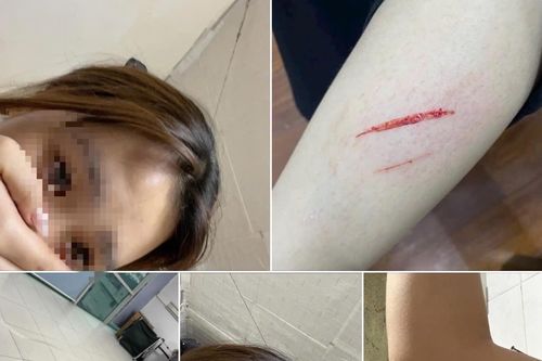 Công an xác minh vụ nữ sinh viên bị hành hung vì tiền bo