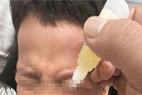 Chữa bệnh về mắt theo mẹo: Lợi bất cập hại