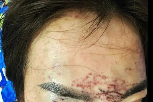 Khởi tố vụ án người phụ nữ 'tố' bị bắt giữ, đánh đập, xăm mặt vì ghen