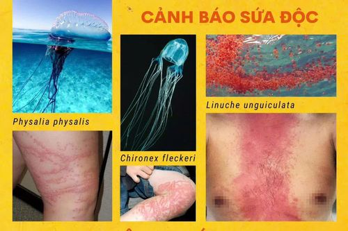 Người dân và du khách cẩn trọng với sứa lửa xuất hiện tại các bãi tắm ở biển Nha Trang