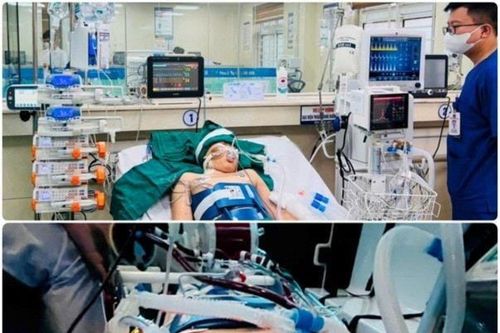 Câu chuyện về phép màu thần kỳ ở Bệnh viện Bạch Mai giúp cậu bé 12 tuổi hồi sinh