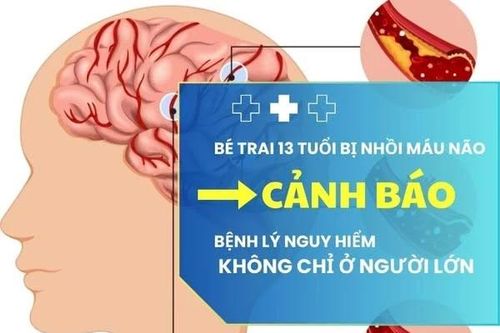13 tuổi nhồi máu não, bệnh nguy hiểm không chỉ ở người lớn
