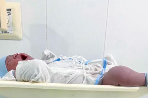 Sinh mổ thành công bé trai gần 6 kg tại Bệnh viện Đa khoa Trần Văn Thời