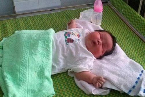 Nhận biết những dấu hiệu bất thường ở trẻ sơ sinh