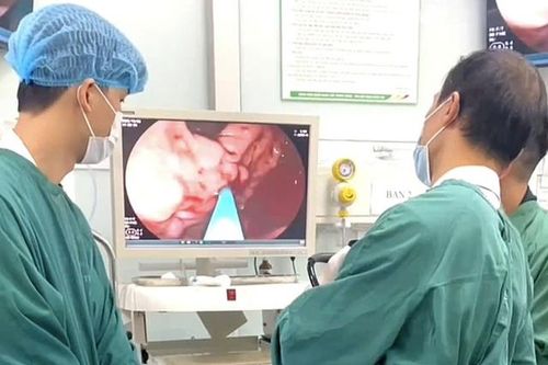 Nghĩ đau bụng bình thường, người đàn ông vào viện đã vỡ tĩnh mạch, máu phun thành tia trong dạ dày