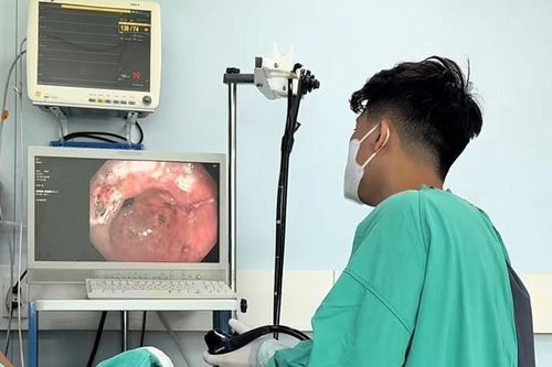 Ngất xỉu tại nhà, cụ ông được phát hiện chảy máu dạ dày nặng
