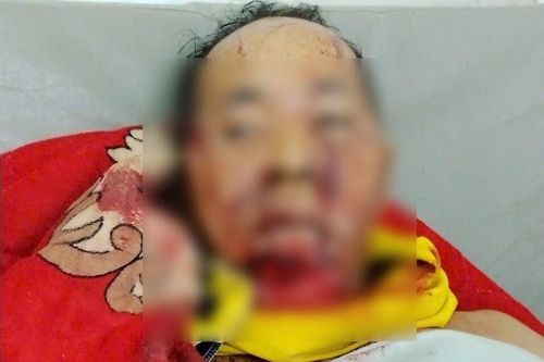 Một trưởng thôn ở Đà Nẵng bị gấu rừng tấn công