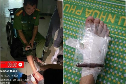Thượng tá Công an bị gỗ đâm xuyên bàn chân khi hỗ trợ người dân