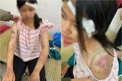 Khởi tố 3 người bạo hành bé gái 13 tuổi ở Thái Nguyên