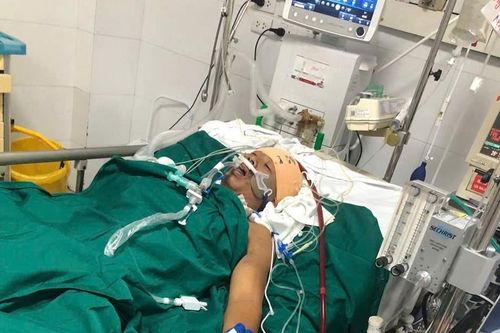 Dập nát ngực, phổi do rơi từ tầng 4, thợ xây vượt cửa tử sau 5 ngày đặt ECMO
