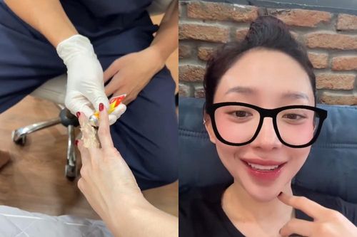 Tóc Tiên chia sẻ về việc xóa hình xăm cũ sau 10 năm với 'người cũ'