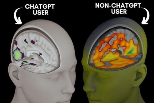 Cảnh báo tình trạng suy giảm nhận thức do lạm dụng trí tuệ nhân tạo