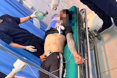 Mâu thuẫn trong lúc nhậu, hai anh em chém bị thương nhiều người