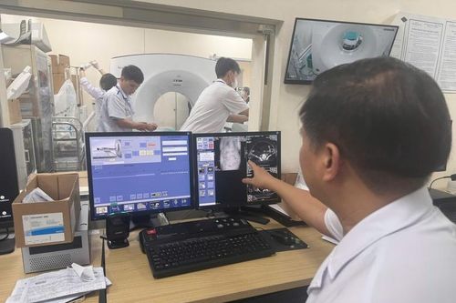 Đưa dịch vụ kỹ thuật chẩn đoán hình ảnh không cần phim in vào Quỹ BHYT chi trả