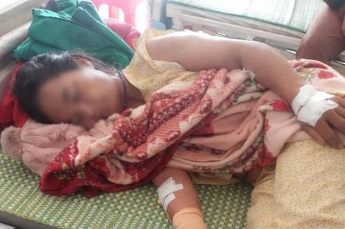 Thêm một trường hợp ngộ độc sau khi ăn cá ủ chua