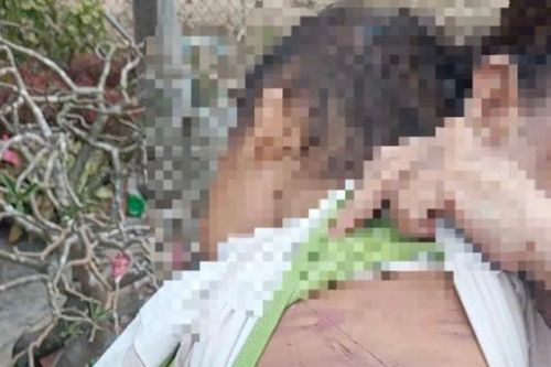Cơ sở y tế có thể là 'cửa ngõ' phát hiện trẻ em bị bạo hành