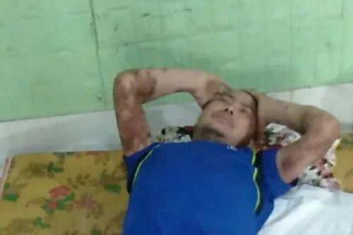 Mở rộng lòng từ: Người đàn ông mắc nhiều bệnh