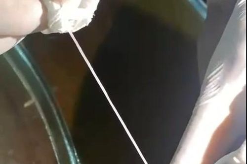 Việt Nam ghi nhận ca mắc giun rồng thứ 44: Kéo ra 2 đoạn 'giun trắng' dài hàng chục cm từ cánh tay
