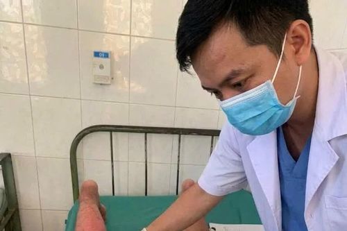 Bị bỏng da vì đắp tỏi, rượu để chữa đau