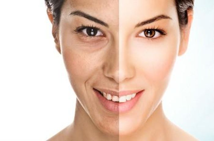  Làn da thiếu sức sống. Nếu làn da bị xỉn màu và thiếu sức sống cũng là dấu hiệu cho thấy, bạn cần phải thay đổi chế độ ăn. Có điều này do bạn ăn quá ít chất béo và làn da không được cung cấp những dưỡng chất cần thiết. Chất béo giúp giữ ẩm, duy trì sự săn chắc cho làn da và tạo điều kiện cho thuận lợi để nuôi dưỡng sức khỏe, sắc diện của làn da. 