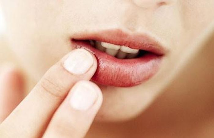 Môi bị nứt nẻ. Tất cả chúng ta đều bị khô môi vào mùa đông, nhưng tình trạng môi bị khô cũng có thể do cơ thể bị thiếu kẽm hay vitamin nhóm B. Hai loại dưỡng chất này bị thiếu do chế độ ăn uống không lành mạnh và hệ thống miễn dịch hoạt động kém. Để ngăn chặn và xử lý tình trạng môi khô, bạn nên ăn nhiều loại thực phẩm giàu kẽm và vitamin nhóm B như các loại hạt, cacao, cá và sữa chua hữu cơ.