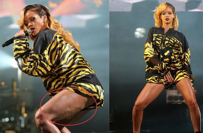  Nhìn qua tưởng Rihanna nuột nà nhưng cặp đùi của cô cũng bị chứng sần vỏ cam.