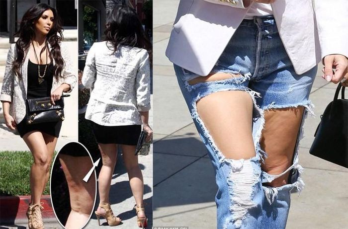  Là ngôi sao rất chăm chút vẻ ngoài và chăm đi tu sửa sắc đẹp ở thẩm mỹ viện, nhưng Kim Kardashian vẫn không tránh được chứng sần vỏ cam đáng ghét.
