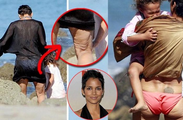 Phía mặt sau đùi và mông của Halle Berry lồi lõm phát sợ, trái ngược hẳn với toàn bộ cơ thể tuyệt đẹp của nữ diễn viên 47 tuổi.