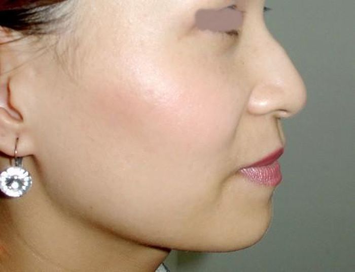 6. Phụ nữ có sống mũi gồ thường là người sống bao dung, biết thông cảm cho người khác nhưng lại hay gặp lận đận trên đường tình. Những người này tính cách thường không ổn định. Người có mũi như dao cũng là tuýp người tương tự.