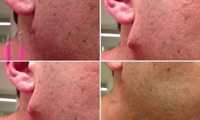 Chàng trai này sở hữu sợi tóc mọc ngược trên mặt dài nhất thế giới?