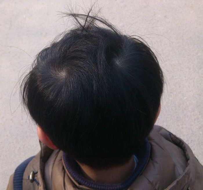 Tuy bề ngoài không thể hiện ra nhưng họ là người vô cùng kiên cường. Không thích bị bó buộc và không muốn làm những việc bị bắt ép. Nhưng đây cũng chính là điểm yếu khiển họ đôi khi phải nếm trải cảm giác cay đắng của thất bại. Trẻ có hai xoáy trên đầu thì đều vô cùng thông minh, học một biết mười, vô cùng lì lợm. Bé trai mà có hai xoáy thì là người luôn lấy chữ hiếu giữ hàng đầu, bé gái mà có hai xoáy thì ngược lại.